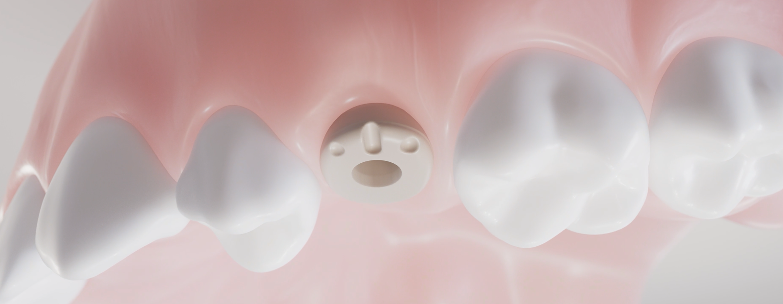 Gingividual-uutinen (1).png